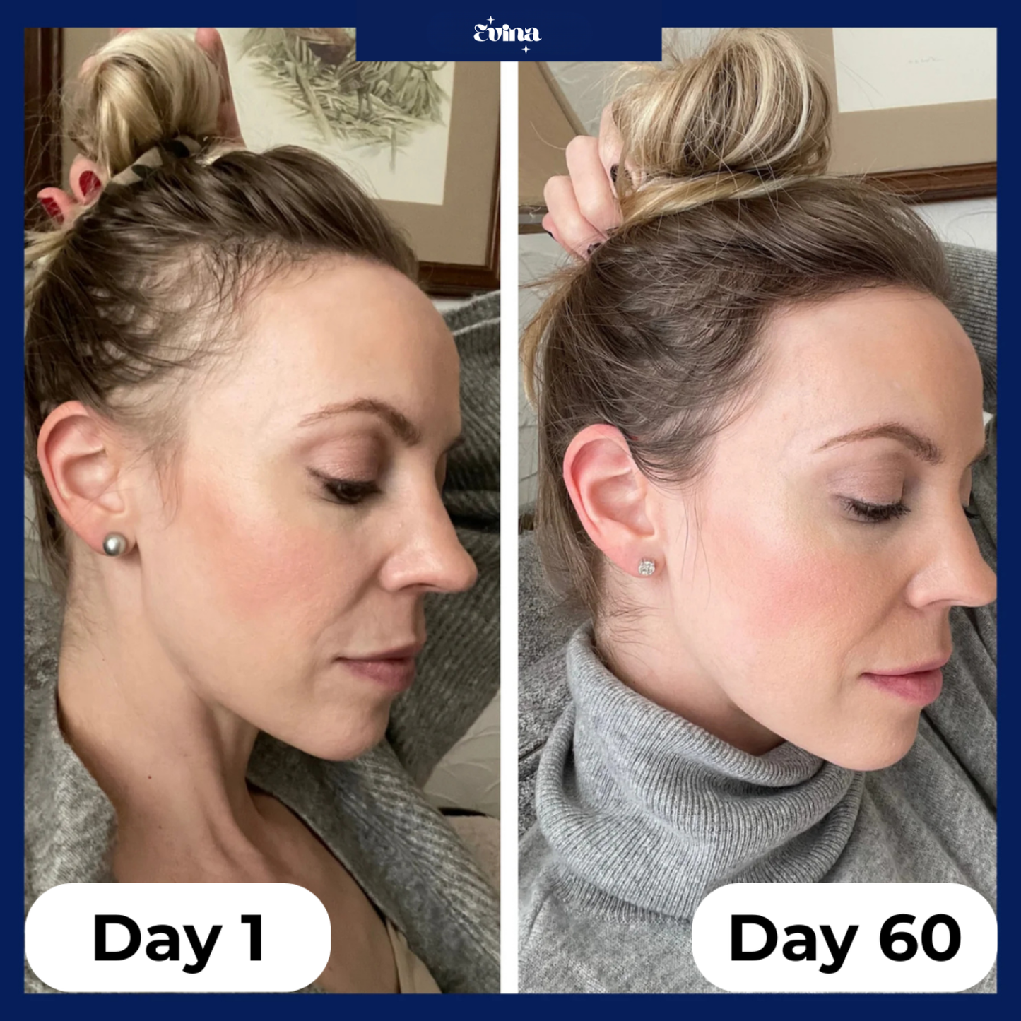 Evina HairRevive™ Roll-On Serum