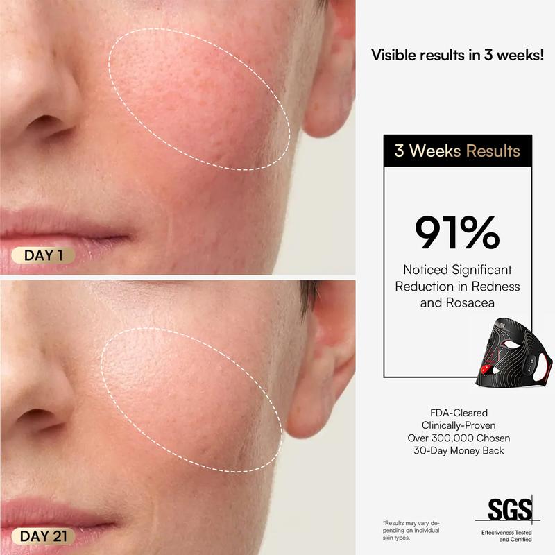 Evina™ Red-Light Therapy Mask