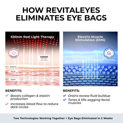 RevitalEyes® 2-in-1 Red Light Therapy + EMS To Erase Eye Bags