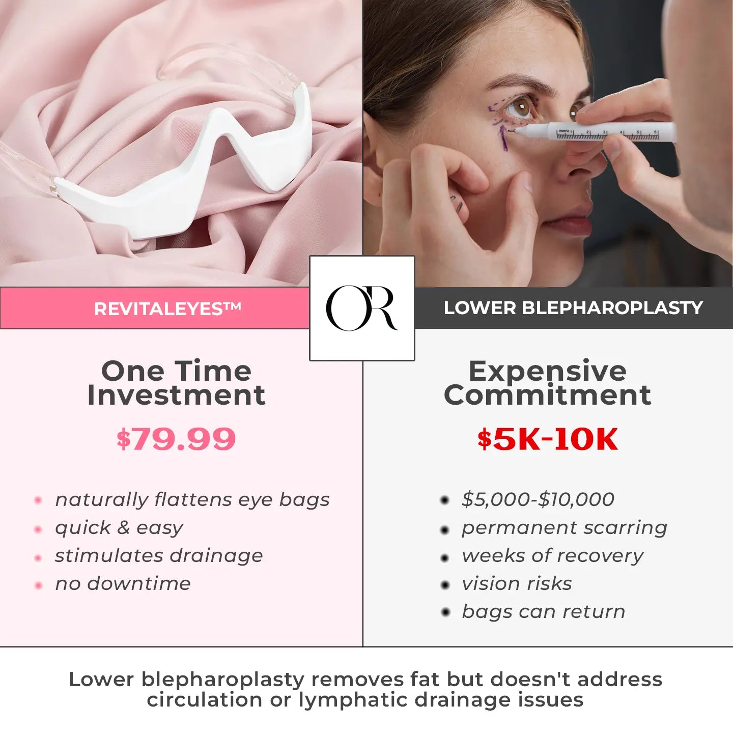 RevitalEyes® 2-in-1 Red Light Therapy + EMS To Erase Eye Bags