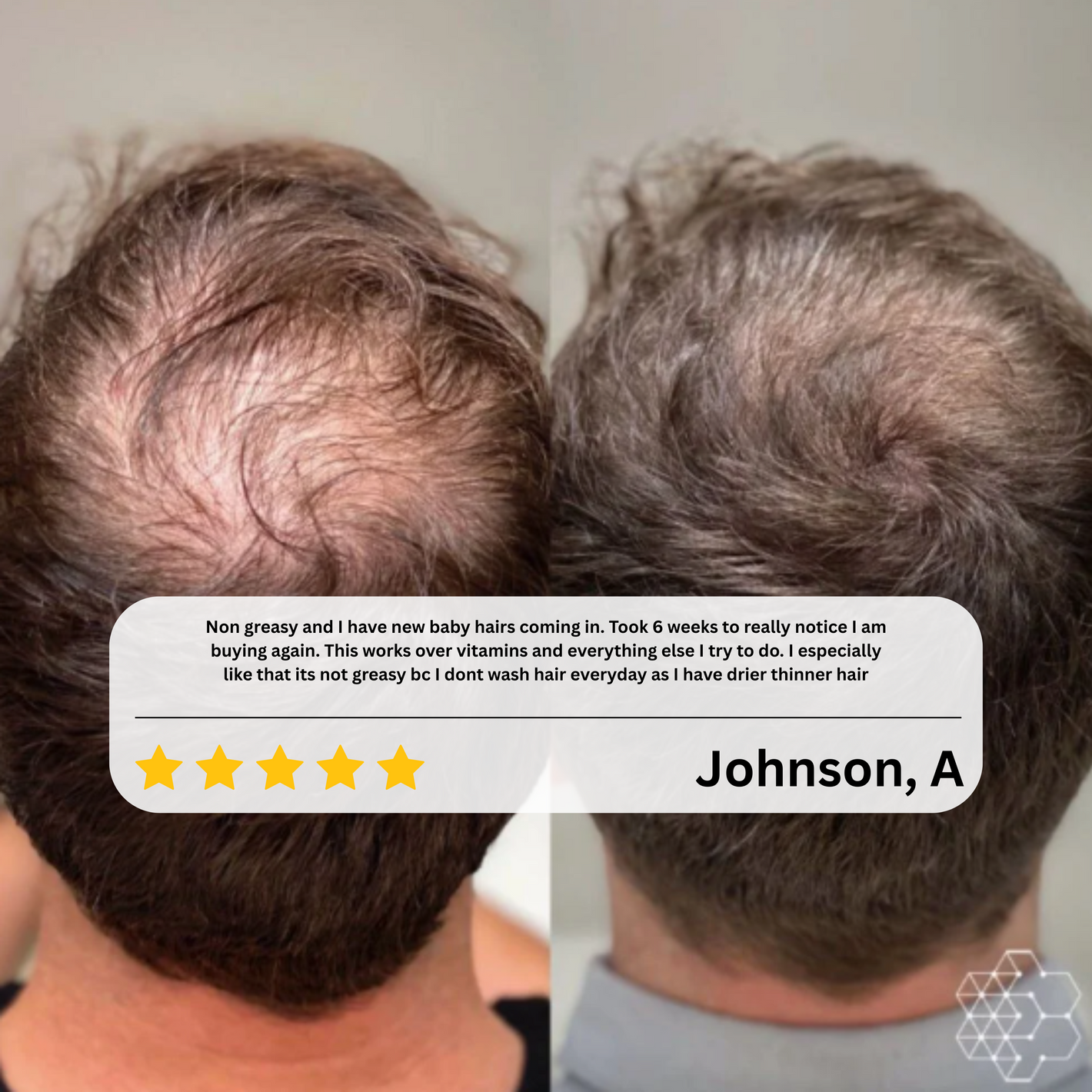 Evina HairRevive™ Roll-On Serum