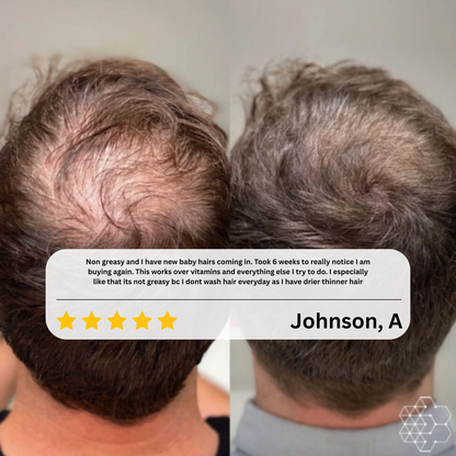 Evina HairRevive™ Roll-On Serum